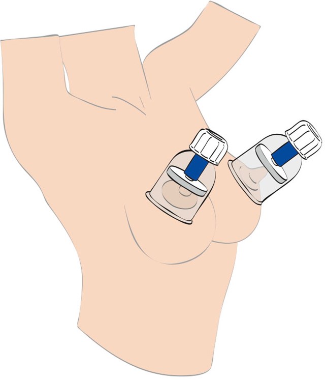 Max Twist XL Nipple Sucker