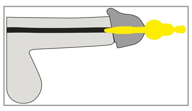 Vibrerende Penisplug